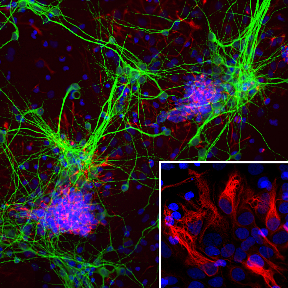 Immunofluorescent analysis of cortical neuron-glial cell culture from E20 rat stained with mouse mAb to nestin, MO22183, dilution 1:500 in red, and costained with chicken pAb to MAP2 in green.