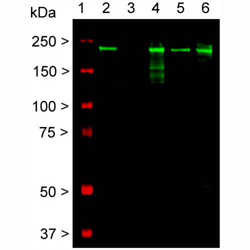 Western blot detection of the heavily phosphorylated axonal form of NF-H protein (pNF-H) in neural tissue lysates (20µg/lane) with affinity purified mouse monoclonal anti-pNF-H antibody at dilution of 1:5,000. Lanes on the blot are: [1] Protein size marker, [2] Adult rat whole brain [3] Embryonic (E20) rat whole brain [4] Adult rat spinal cord [5] Adult mouse whole brain [6] Adult mouse spinal cord.