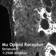 Mu Opioid Receptor Blocking Peptide