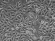 PC-3 cells in culture.
