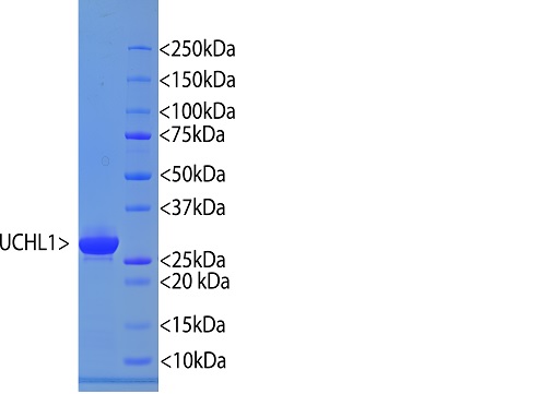 His-tagged-UCHL1, was expressed and purified from E. coli BL21 using immobilized metal affinity chromatography. Protein concentration was determined using BSA Protein Bradford, and confirmed with a densitometry-based ImagJ quantification using BSA as standard. Picture shows the Coomassie gel of UCHL1 and BSA at serial dilution. UCHL1 runs at ~37 kDa.