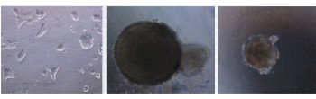 ES Cells with LIF, embryoid bodies and ES Cells without LIF