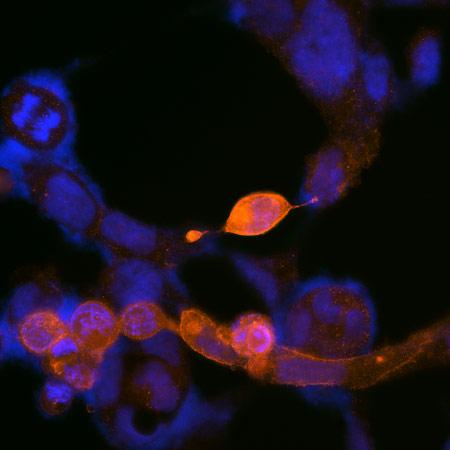 HEK293 transiently transfected with KOR. Specific signal is red, nuclei-stained with DAPI (blue).