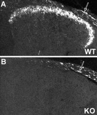 NPY Y2 receptor immunoreactivity in mouse dorsal root ganglion of wild type (A) and NPY Y2 receptor Knockout (B) animals. Note that unspecific staining is observed in thick, possibly myelinated fibers. Image courtesy of Dr. Tomas Hökfelt, Karolinska Institute.