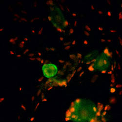 TRPA1 staining of rat DRG using FITC-conjugated donkey anti-rabbit secondary antibodies (green color) and propidium iodide as a counterstain.