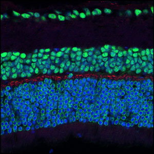 Confocal microscopic image of mouse retina labeled with Phospho-NMDAR1 (Ser890) Antibody (red) and CREB Mouse mAb (green). Blue pseudeocolor stain = DRAQ5® (fluorescent DNA dye).