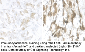 Parkin