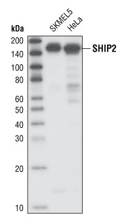 Western blot analysis of total cell lysates from SKMEL5 and HeLa cells, using SHIP2 Antibody.