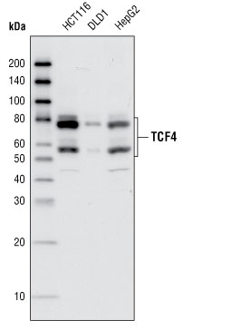 Western blot analysis of total cell lysates from HCT116, DLD1 and HepG2 cells using TCF4 (C9B9) Rabbit mAb.