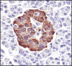 C-Peptide staining of Human Pancrease Tissue