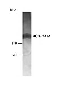 BRCAA1 antibody (ab36962) + MCF7 whole cell lysate (15 µg). Predicted Band at 136kDa.