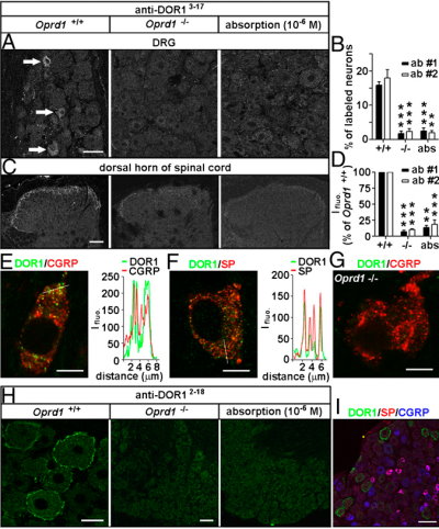 Distinct distribution patterns of DORs in subsets of DRG neurons of mice. Immunostaining with antibodies against DOR13–17. www.pnas.org/cgi/doi/10.1073/pnas.1008382107