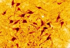 5HT Serotonin staining of rat hypothalamus
