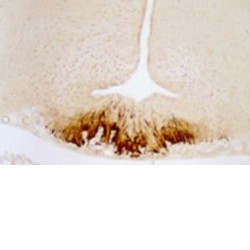 CRF staining of rat hypothalamus(median eminence)