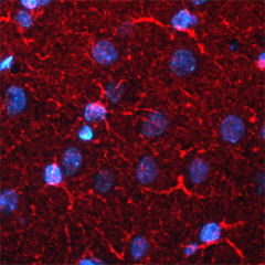 Immunohistochemical detection of BACE-1 in astrocytes in rat cortex. Rat brain was fixed with 4% formaldehyde and cut into 10 μm thick cryostat sections. Tissue was incubated with rabbit polyclonal antibody to BACE-1 at 10 μg/mL overnight at 4°C followed by incubation with Donkey anti-rabbit Rhodamine Red conjugated secondary antibodies at 1:200 dilution. Nuclei were counterstained with DAPI (blue).