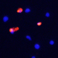 Immunohistochemical detection of Caspase 3 in apoptosis induced Jurkat cells. Cells were fixed with 1% formaldehyde incubated with rabbit polyclonal antibody to N-terminal region of Caspase 3 at 6 μg/mL overnight at 4°C followed by incubation with Donkey anti-rabbit Rhodamine Red conjugated secondary antibodies at 1:200 dilution. Nuclei were counterstained with DAPI (blue).