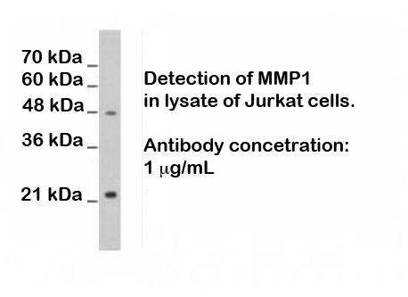 Western blot analysis using RA21020
