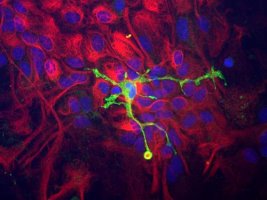 Immunocytochemistry of a mixed neuron/glial culture from newborn rat brain stained with Coronin 1a (green) at a dilution of 1:10,000 and chicken polyclonal Vimentin (1:5,000). Blue is nuclear DNA counter stain. Glial cells and fibroblasts stain with vimentin, while microglia alone stain strongly and specifically for Coronin 1a, which can therefore be used as a robust marker of this important cell type.