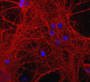 Mixed neuron-glial cultures stained with rabbit antibody to GAP43 (red), blue is DNA staining.