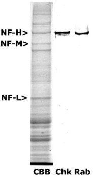 Lane labelled CBB shows Coomassie Brilliant Blue stained crude extract of rat spinal cord, with the prominent major neurofilament subunit indicated; In rodents, NF-H runs at 200kDa, NF-M at 145kDa and NF-L at 68kDa. A prominent band at an apparent SDS-PAGE molecular weight of 200kDa corresponds to phosphorylated form of NF-H. The lane marked Rab shows a similar blot probed with our rabbit antibody to NF-H.