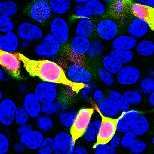 HEK293 cells transfected in the same way and viewed in the confocal microscope. Most HEK293 cells are not transfected so only the nucleus of these cells can be visualized with a blue DNA stain. Cells which are transfected with mCherry are red. Staining with mCherry (RA22117) is shown in Green. courtesy of the Semple-Rowland lab at the University of Florida.