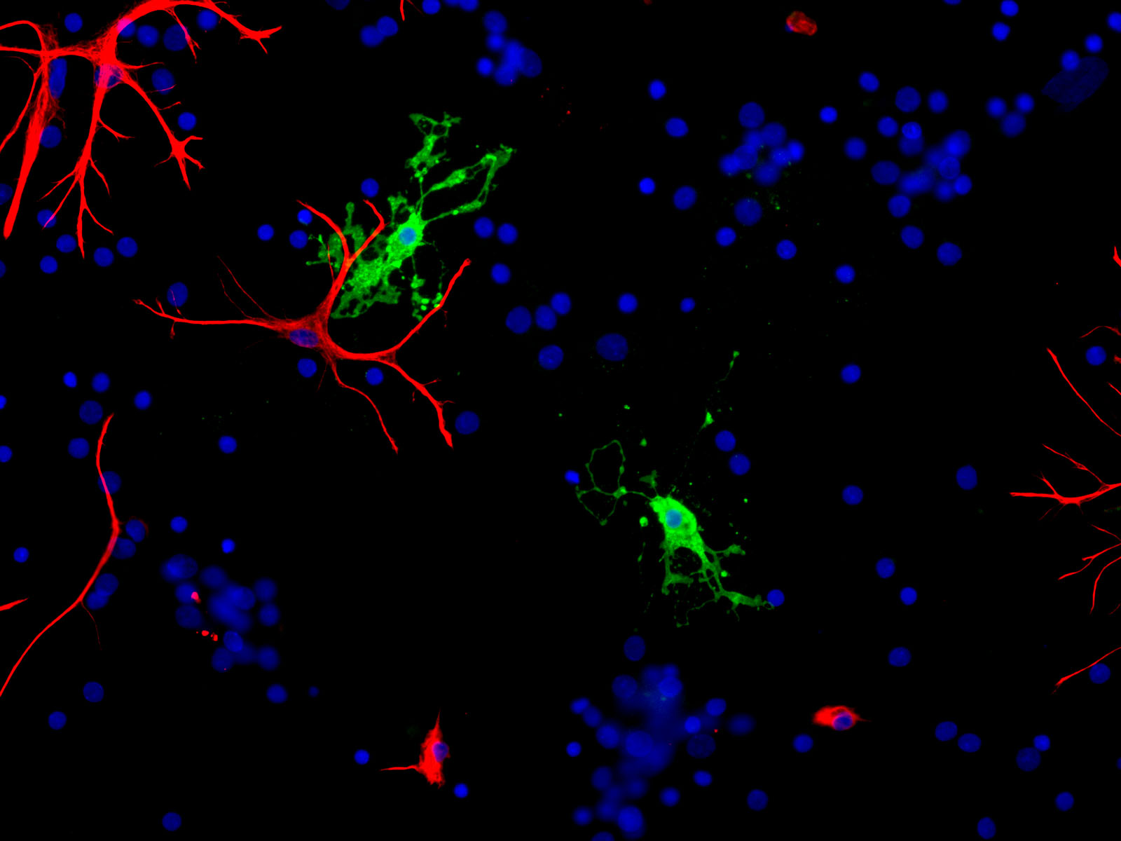 Mixed neuron-glial cell cultures stained with RA22120 (green) and our monoclonal antibody against GFAP (red, MO22136). The CNP antibody stains strongly in oligodendrocytes, whereas GFAP labels the intermediate filament in astrocytes. Blue is DNA staining showing the nuclei of these and numerous other cells, most of which are neurons and which do not express either CNP or GFAP.