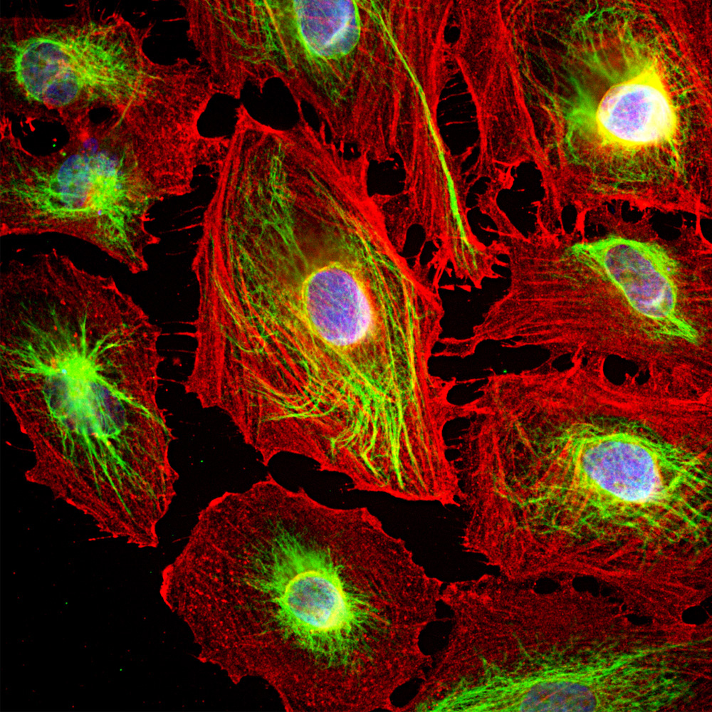 Immunofluorescence analysis of HeLa cells costained with rabbit pAb to vimentin, RA22124, dilution 1:5,000, in green, and mouse mAb to Actin dilution 1:500, in red. Blue is DAPI staining of nuclear DNA. The vimentin antibody stains the 10nm or intermediate filament network of the cytoskeleton. The antibody to actin labels the submembranous actin-rich cytoskeleton, stress fibers, and bundles of actin associated with cell adhesion sites
