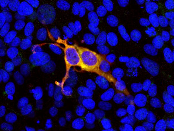 Hek293 cell culture transfected with a construct including the C terminal 814-1372 amino acids of Staphylococcus pyogenes Cas9. The cells were stained with RA22126 in red and also with a chicken antibody to S. pyogenes Cas9 in green. A cell expressing Cas9 therefore appears yellow. Most Hek293 cells are not transfected so only the nucleus of these cells can be visualized with the blue DNA stain.