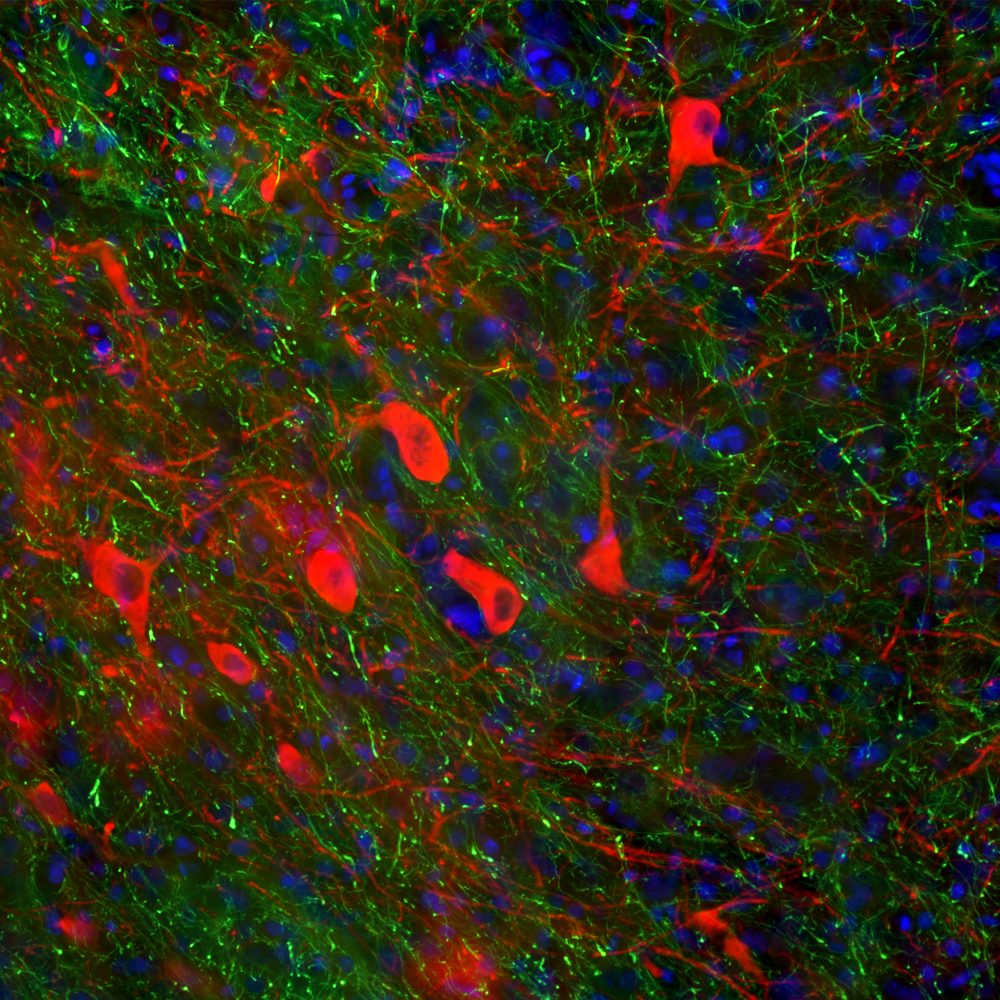 Immunofluorescent analysis of rat brain section stained with rabbit antibody to tyrosine hydroxylase, RA22135, dilution 1:10,000, in red and costained with mouse antibody to pNF-H, MO22187, dilution 1:1,000 in green. The blue is Hoechst staining of nuclear DNA.