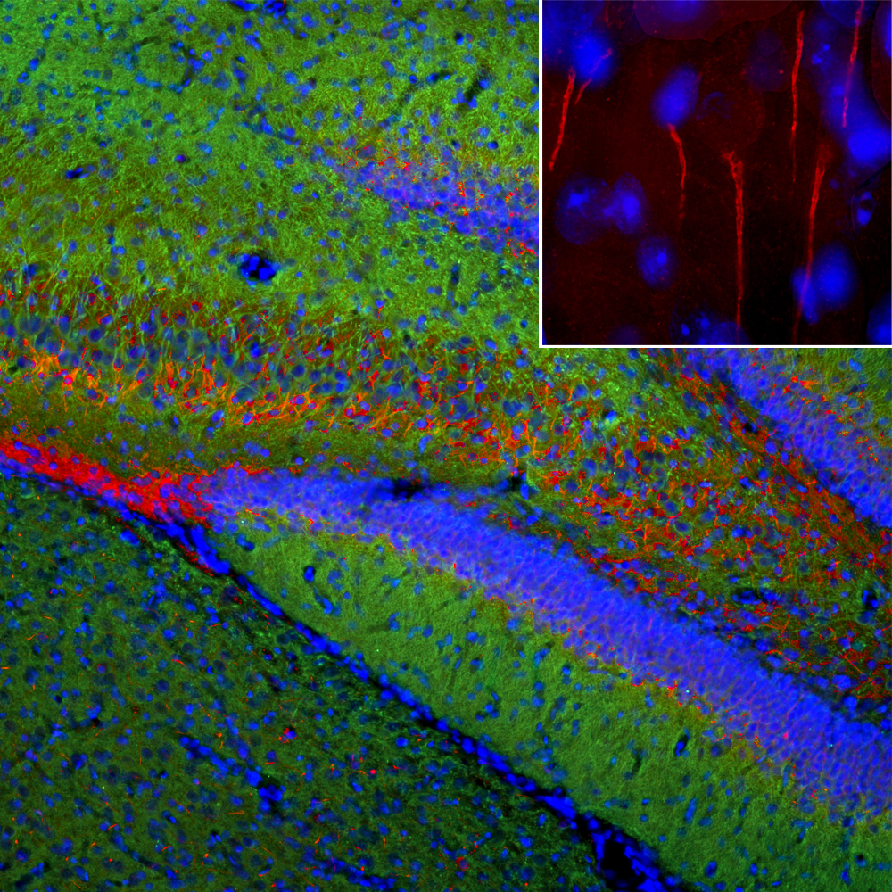 Immunofluorescent analysis of a rat brain section stained with rabbit pAb to ankyrin 3.