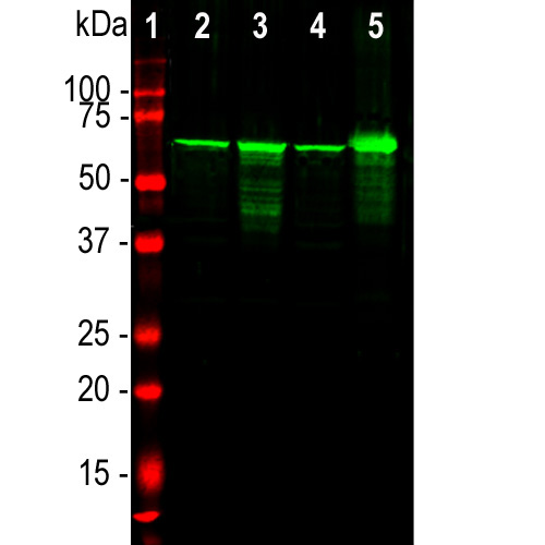 Western blot analysis of different tissue lysates using rabbit pAb to NF-L, dilution 1:20,000. in green. [1] protein standard (red), [2] rat brain, [3] rat spinal cord, [4] mouse brain, [5] mouse spinal cord. The strong band at 68kDa corresponds to the NF-L protein.