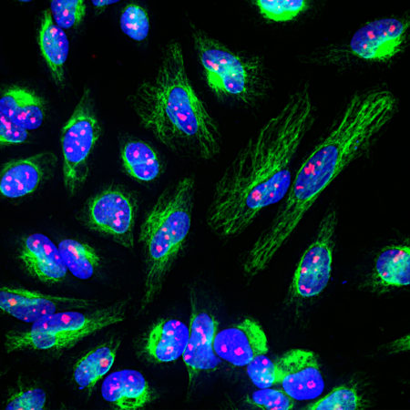 Immunofluorescent analysis of HeLa cells stained with rabbit pAb to fibrillarin, RA22147, dilution 1:5,000 in red, and costained with chicken pAb to vimentin in green. The blue is Hoechst staining of nuclear DNA. RA22147 detects protein expressed in nucleoli of cells, while the vimentin antibody produces strong staining of cytoplasmic intermediate filaments.