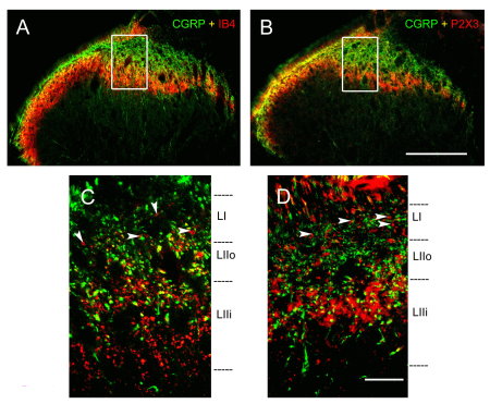 CGRP, IB4 and P2X3 staining in transverse spinal cord sections. A and B show low magnification confocal images of CGRP-IR and IB4 positive. http://www.molecularpain.com/content/8/1/64.