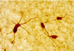 NPY staining of rat brain tissue.