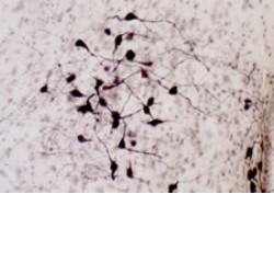 Oxytocin staining of Rat Hypothalamus (PVN/SON). Note: staining is completely eliminated by pretreatment of 1 mL of the diluted antibody with 5 μg of Oxytocin. Pretreatment of 1 mL of the diluted antibody with as much as 100 μg of vasopressin does not diminish staining.