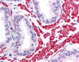OPA1 staining of prostatic smooth muscle and glandular epithelium. 40X Magnification.