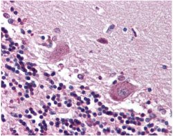 CDR2 staining of Purkinje neurons in the Human cerebellum