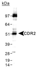 Detection of CDR2 in HeLa whole cell lysates.
