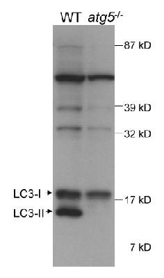 Detection of autophagic LC3 in mouse ES cell lysate. The atg5-/- lane (ES cells, cultured to form embryonic bodies, that are deficient in conversion of LC3-1 to LC3-11) demonstrates the specificity of LC3, as there is no detection of LC3-11. Photo courtesy of Dr. Beth Levine, UT Southwestern Medical Center