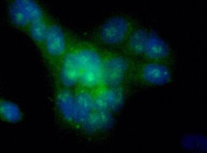 GPR49 staining of HeLa cells (Green) detected with DyLight Fluor 488 conjugated anti-rabbit IgG secondary antibody. Nuclei are counterstained with Hoechst 33258 (Blue).