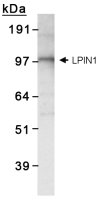 Detection of LPIN1 in 3T3L1 lysate.