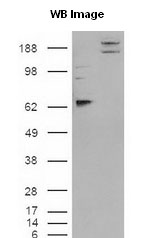Cell were transfected with the pCMV6-ENTRY control or pCMV6-ENTRY CADM1 cDNA for 48 hrs and lysed. Equivalent amounts of cell lysates (5 ug per lane) were separated by SDS-PAGE and immunoblotted with anti-SynCAM