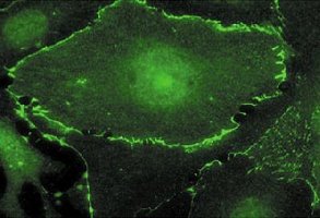 Detection of c-myc Tagged Plakoglobin by Immunofluorescence. Samples: Human microvascular endothelial cells expressing c-myc tagged plakoglobin following transient transfection.