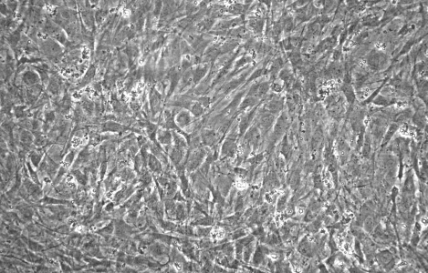 Retinal Pigment Cells in culture.