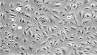 Primary GFP HUVEC’s cultured on SC300 coated plate