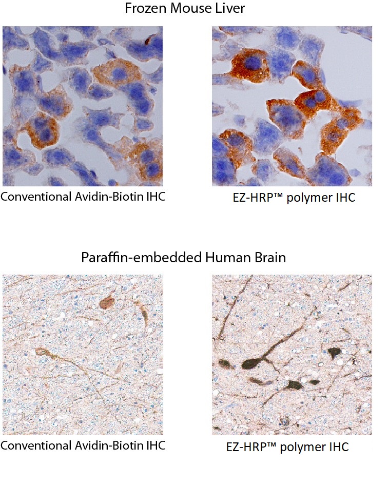 Comparison of IHC images using EZ-HRP™ Polymer vs. a conventional avidin-biotin antibody