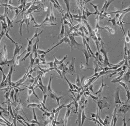 RFP Expressing Human Glioblastoma Cells