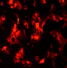RFP Expressing Human Gastric Carcinoma N87 Cells