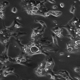 RFP Expressing Human Gastric Carcinoma N87 Cells