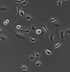 RFP Expressing Human Prostate Carcinoma Cells (DU 145)